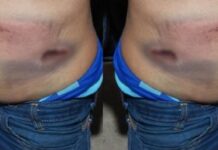 Sobrinho vingativo: Sobrinho espanca marido da tia que termina em perseguição