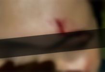 Agressora é presa após atacar à cunhada com facada no rosto em Porto Velho