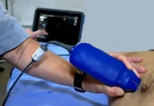 Equipamentos com tecnologia de IA agilizam exames no Pronto-Socorro João Paulo II, em Porto Velho